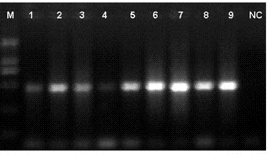 Mouse-tail DNA (deoxyribose nucleic acid) extraction kit applicable to the genotype of laboratory mouse and application thereof