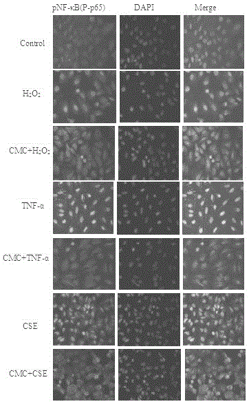 Application of S-(carboxymethyl)-L-cysteine to preparation of medicines for preventing and treating respiratory system diseases