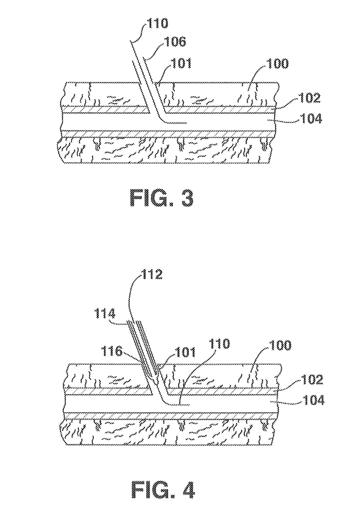 Low-Profile Vascular Closure Systems and Methods of Using Same