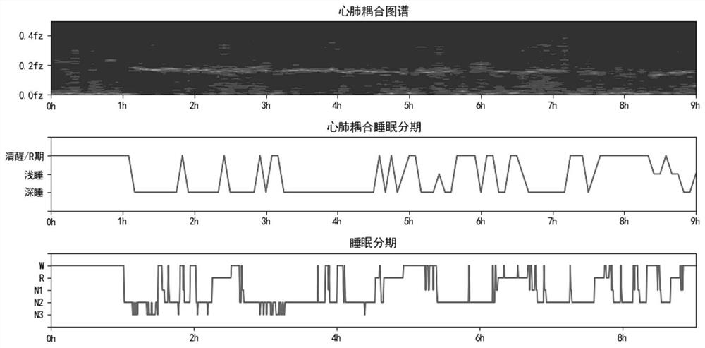 Cardiopulmonary coupling analysis method based on single-channel ECG signal