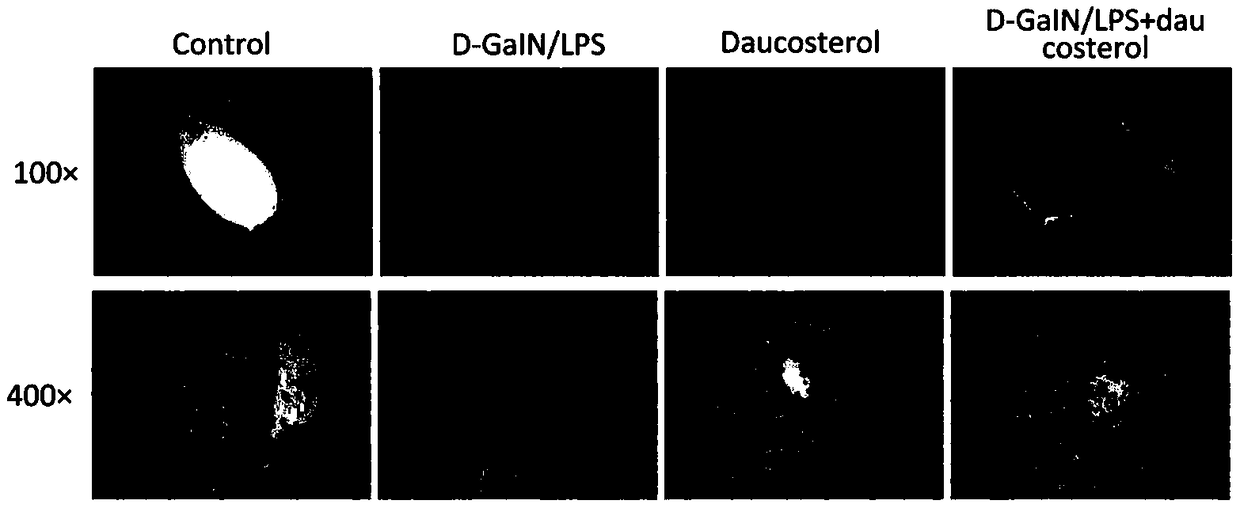 Protective drug for D-GaIN/LPS induced liver injury