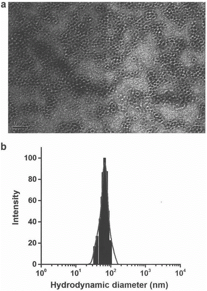 Intelligent nanoparticle capable of specifically accelerating tumor cell apoptosis and monitoring curative effect by itself