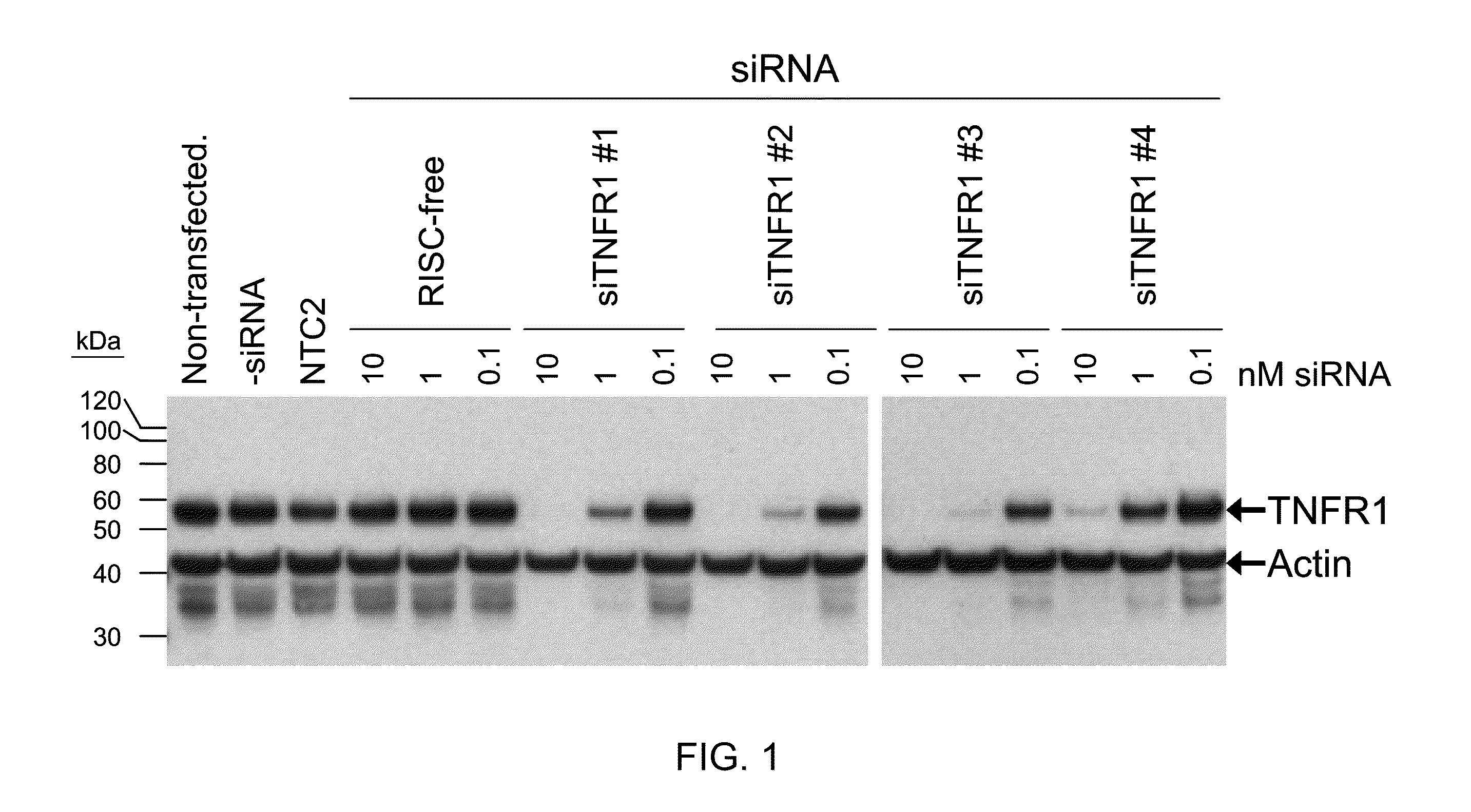 RNAi-RELATED INHIBITION OF TNFa SIGNALING PATHWAY FOR TREATMENT OF OCULAR ANGIOGENESIS