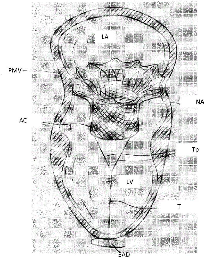 Epicardial anchor devices and methods