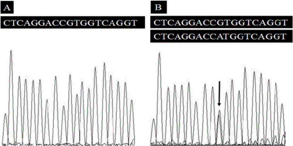 Parkinson disease pathogenic gene and detection kit