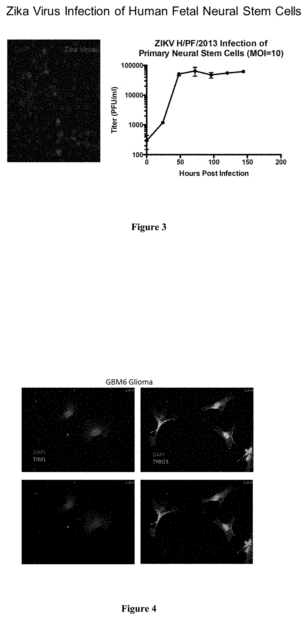 Methods and compositions for treating glioma and medulloblastoma brain tumors using the zika virus