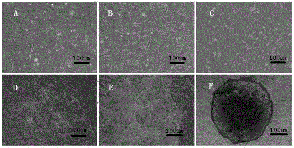 Induced pluripotent stem cell (iPSC) and method for preparing same