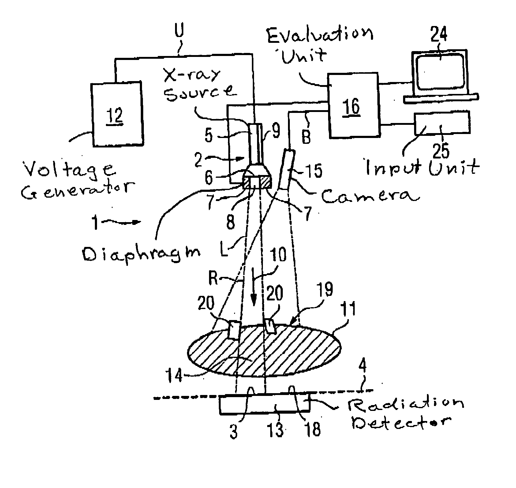 X-ray examination method and apparatus with automatic gating of the x-ray beam