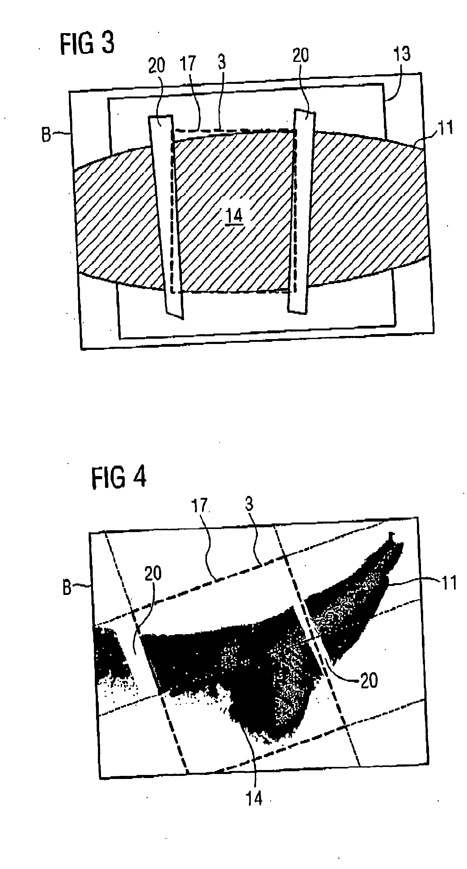 X-ray examination method and apparatus with automatic gating of the x-ray beam