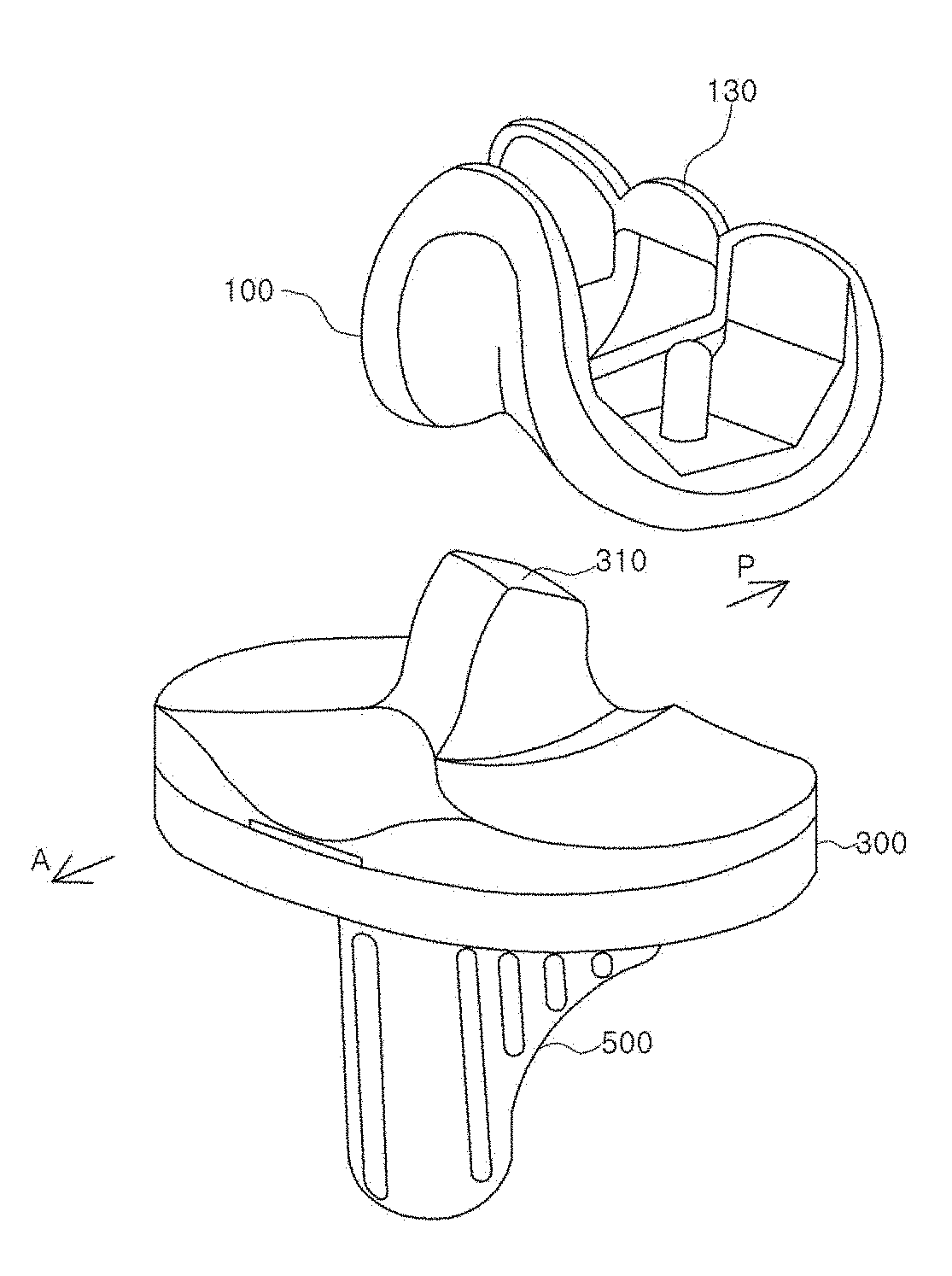 Artificial knee joint capable of preventing dislocation of thighbone coupling member