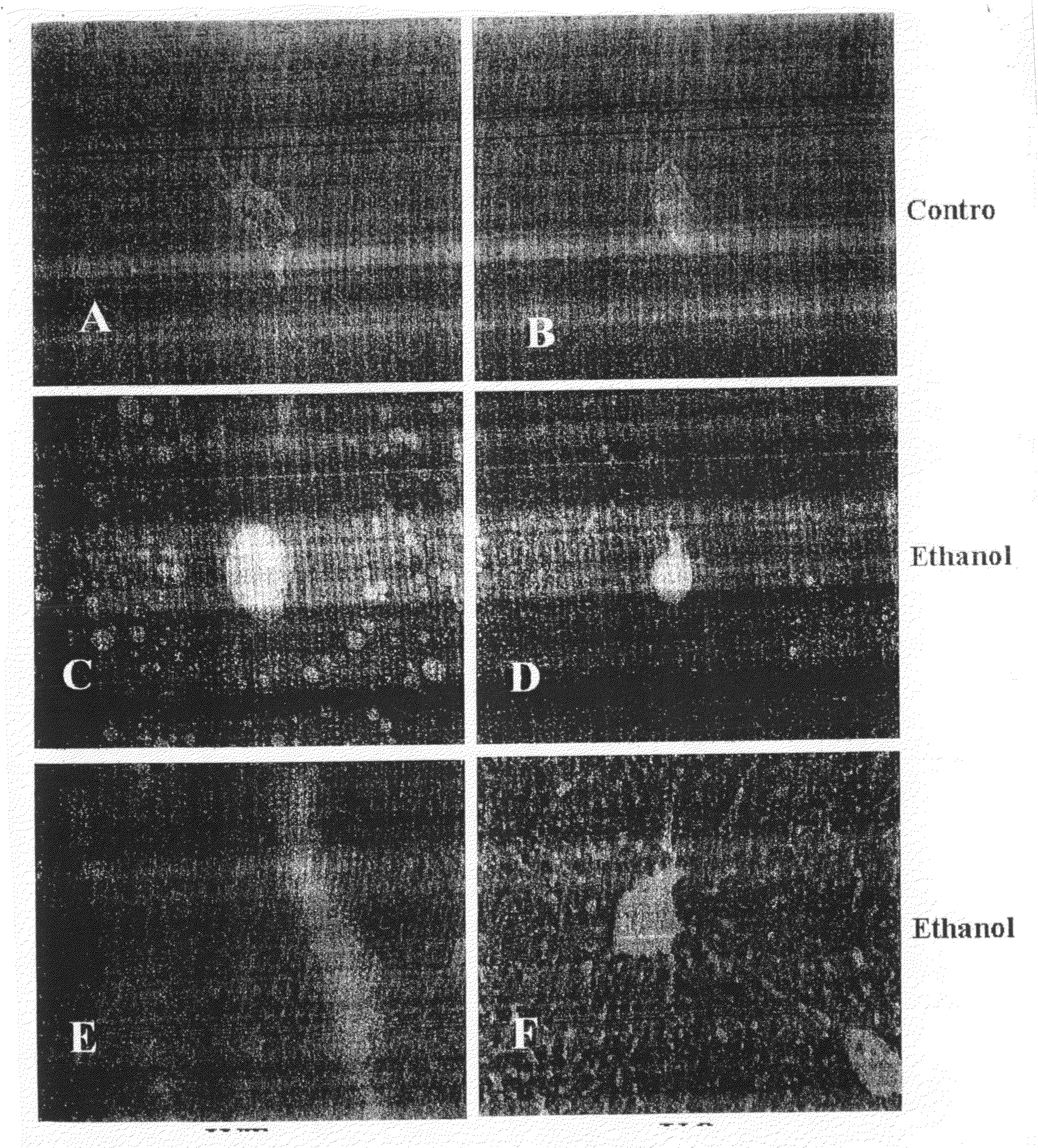 Methods and compositions for treating hepatic diseases