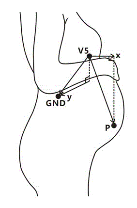 Fetal electrocardiogram orthorhombic lead system