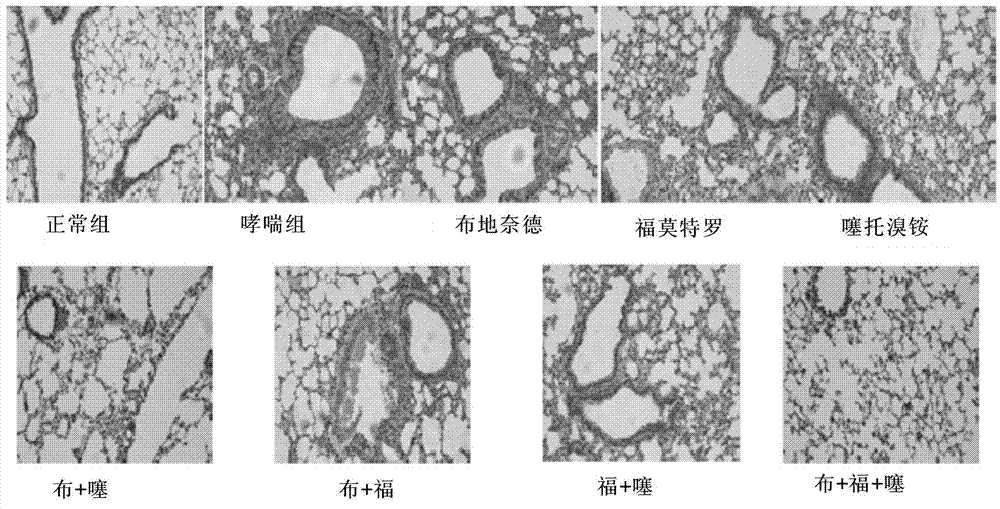 Inhalation pharmaceutical composition used for treatment of chronic obstructive pulmonary disease (COPD) and asthma and preparation method thereof