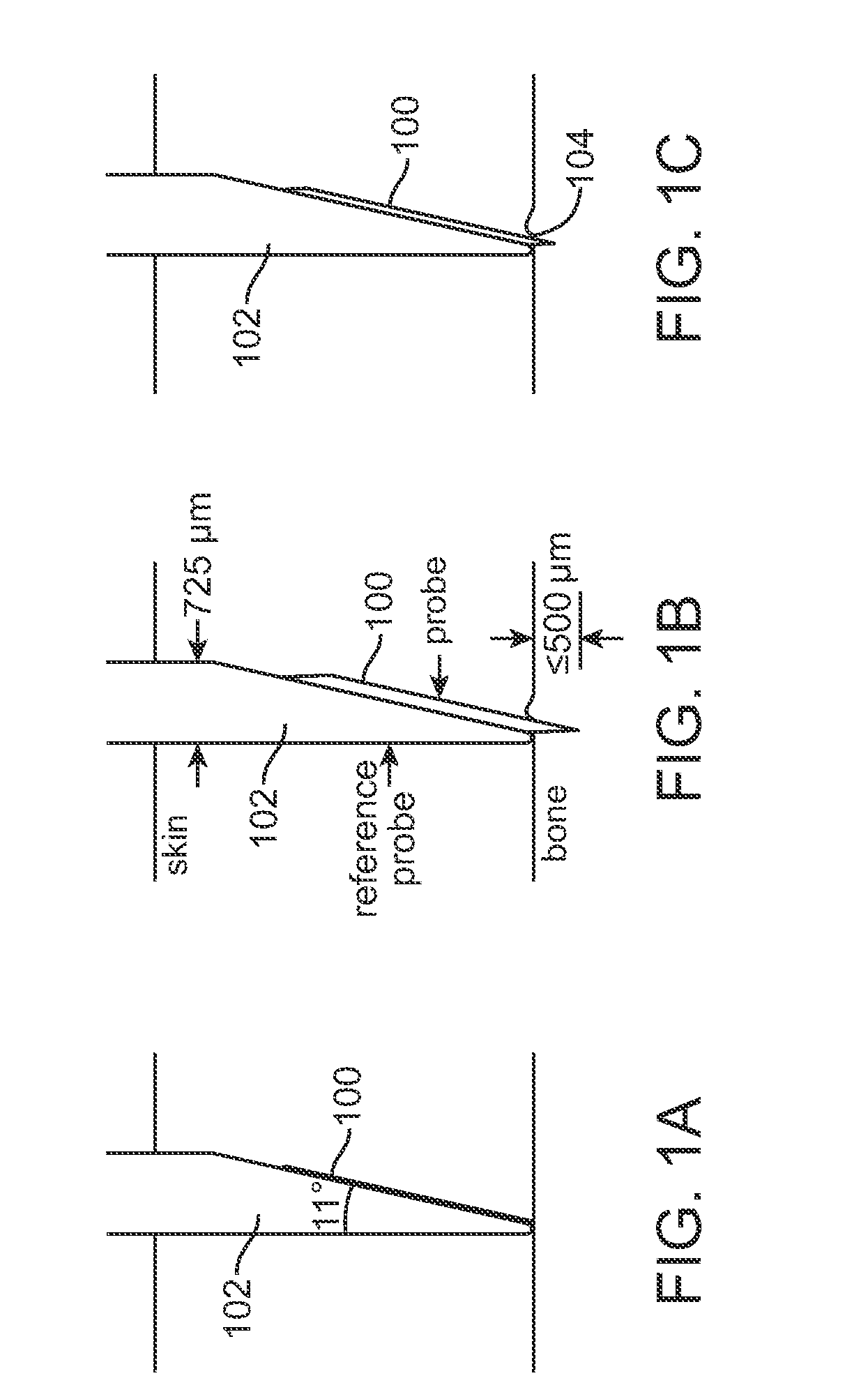 Methods and instruments for assessing bone fracture risk