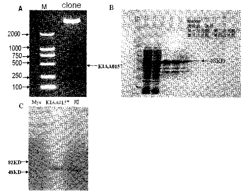 Novel human tumor inhibiting gene KIAA0157 and application thereof