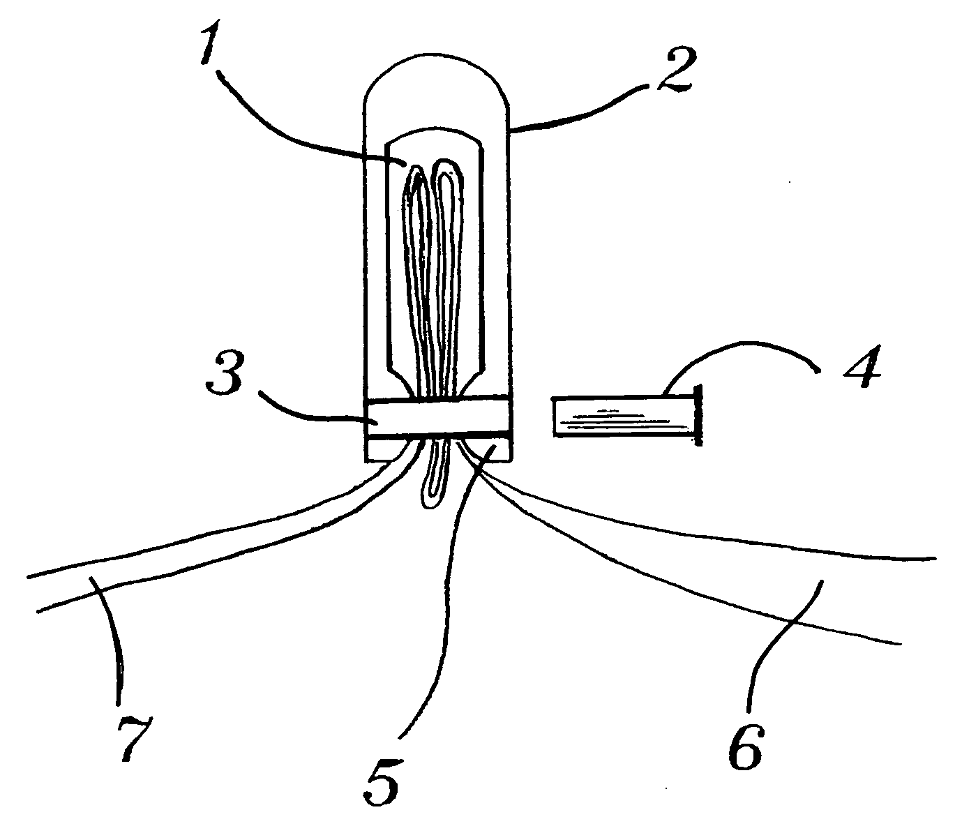 Removable pouch partition