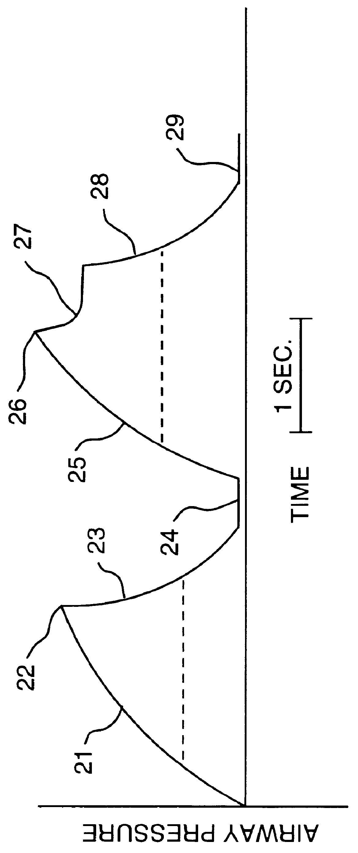 Method and apparatus for breathing during anesthesia
