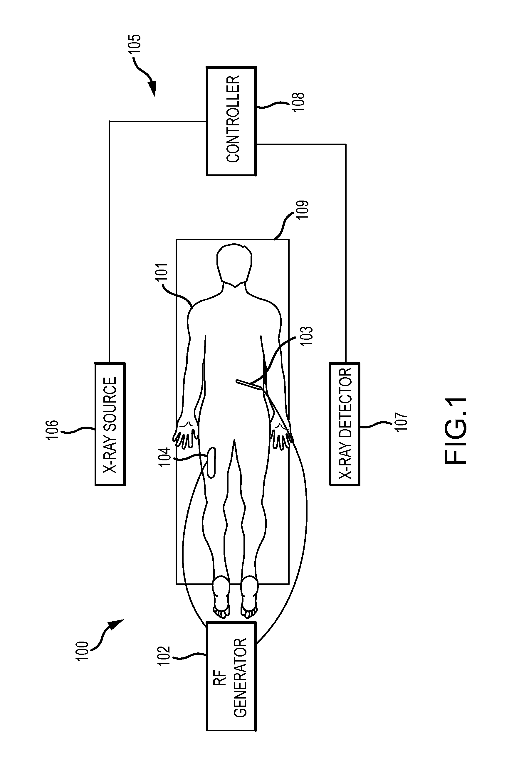 Methods and systems for spinal radio frequency neurotomy