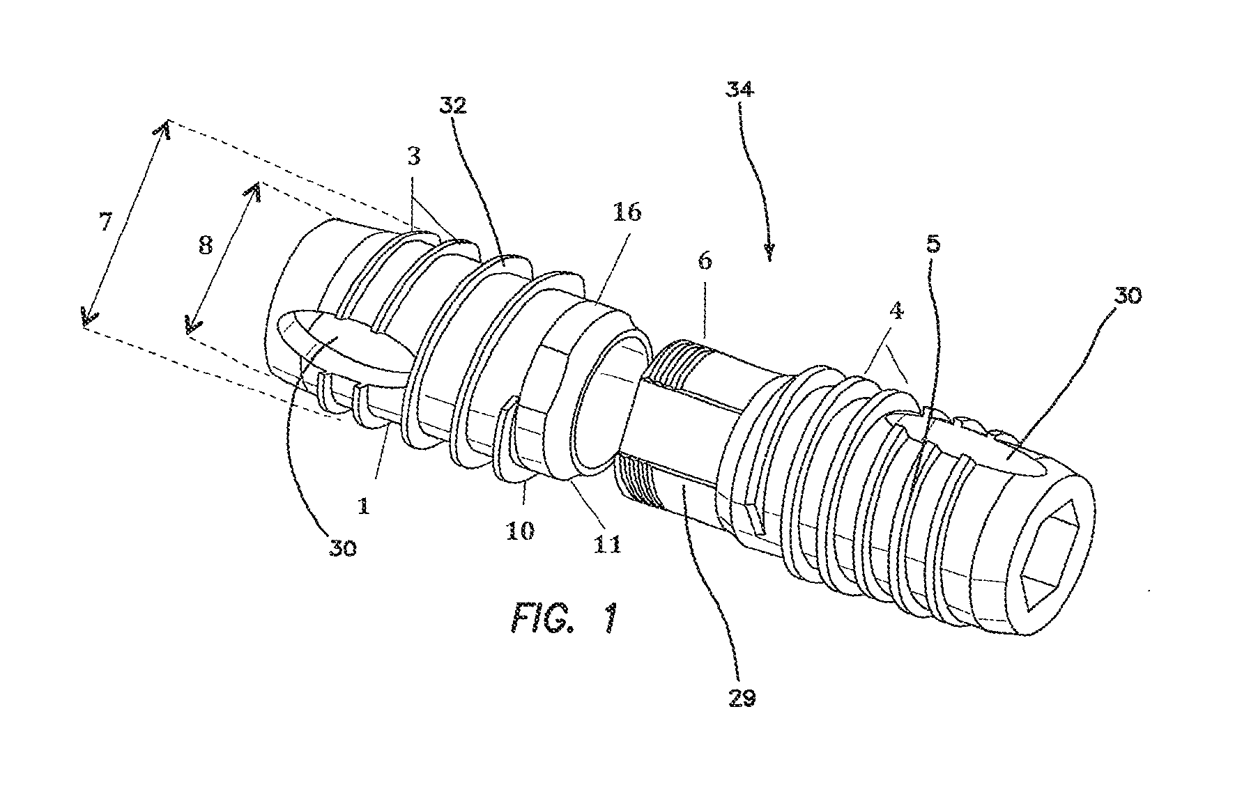 Apparatus and method for use in the treatment of hammertoe