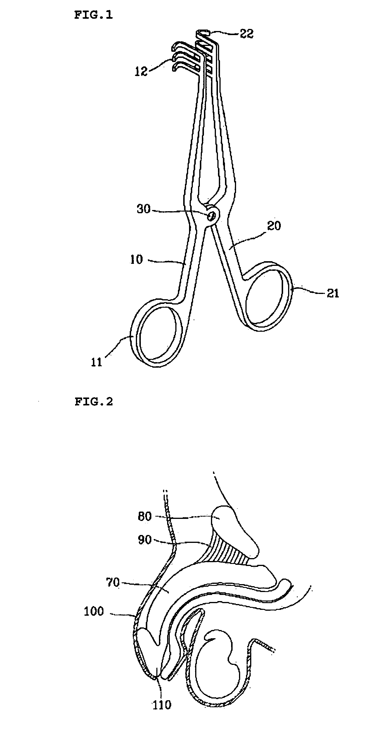 Retracting and dissecting apparatus for surgical operation, and minimal incision penile augmentation using the same