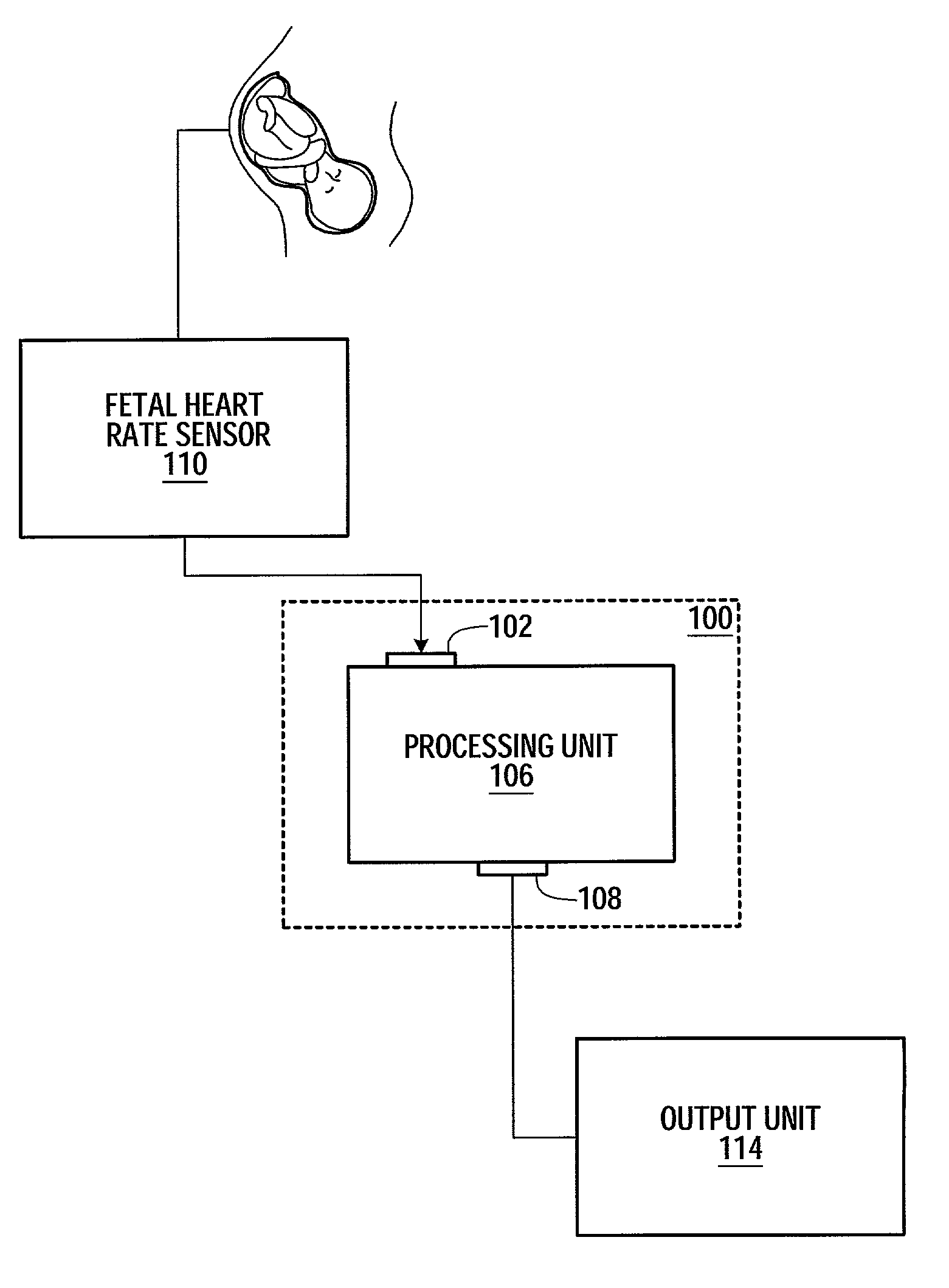 Method and apparatus for monitoring the condition of a fetus