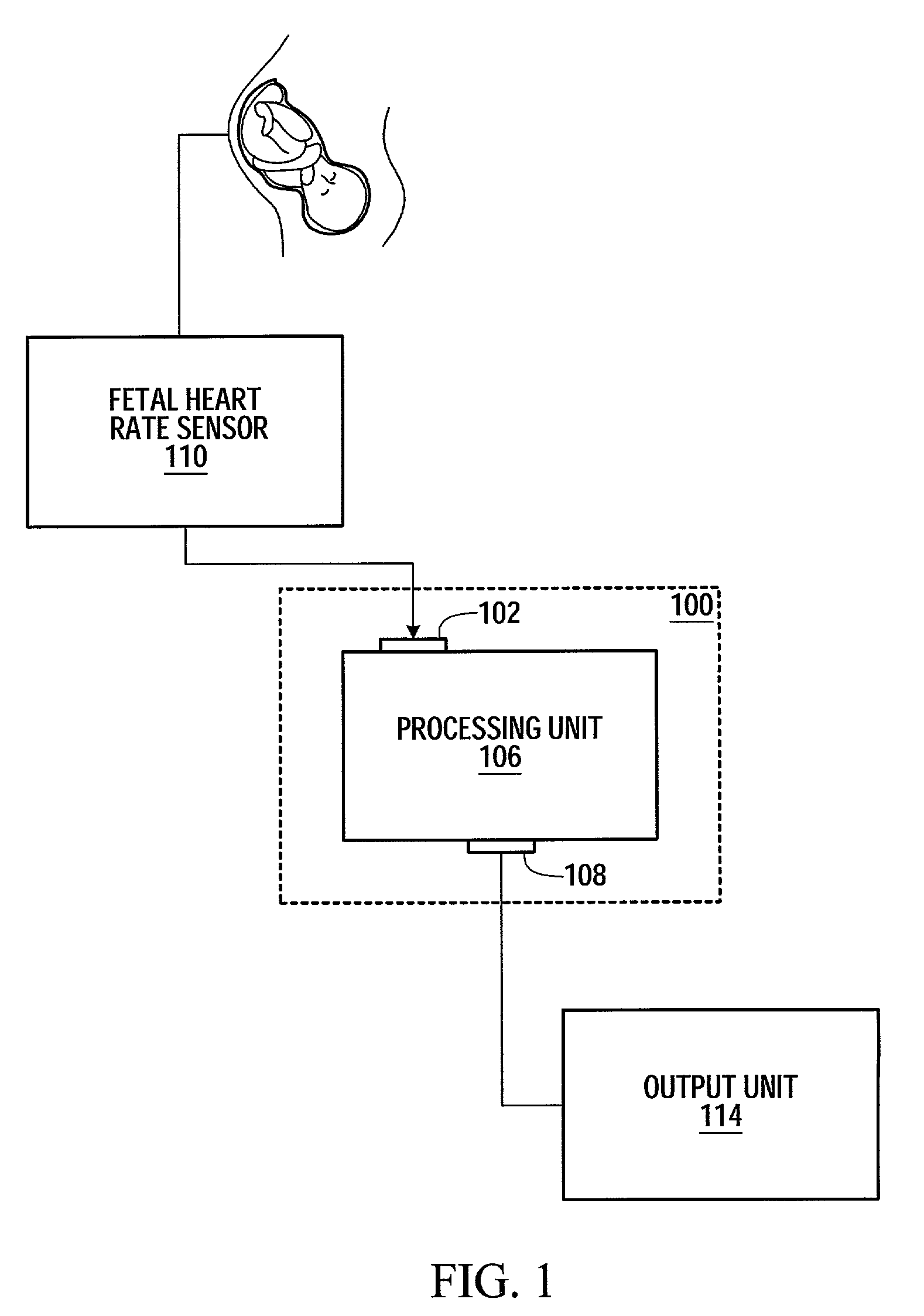 Method and apparatus for monitoring the condition of a fetus