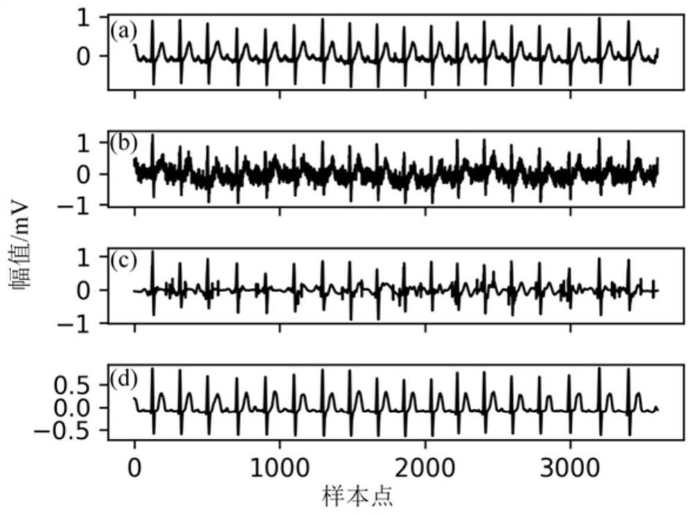 ECG denoising method based on EEMD-Hilbert transformation