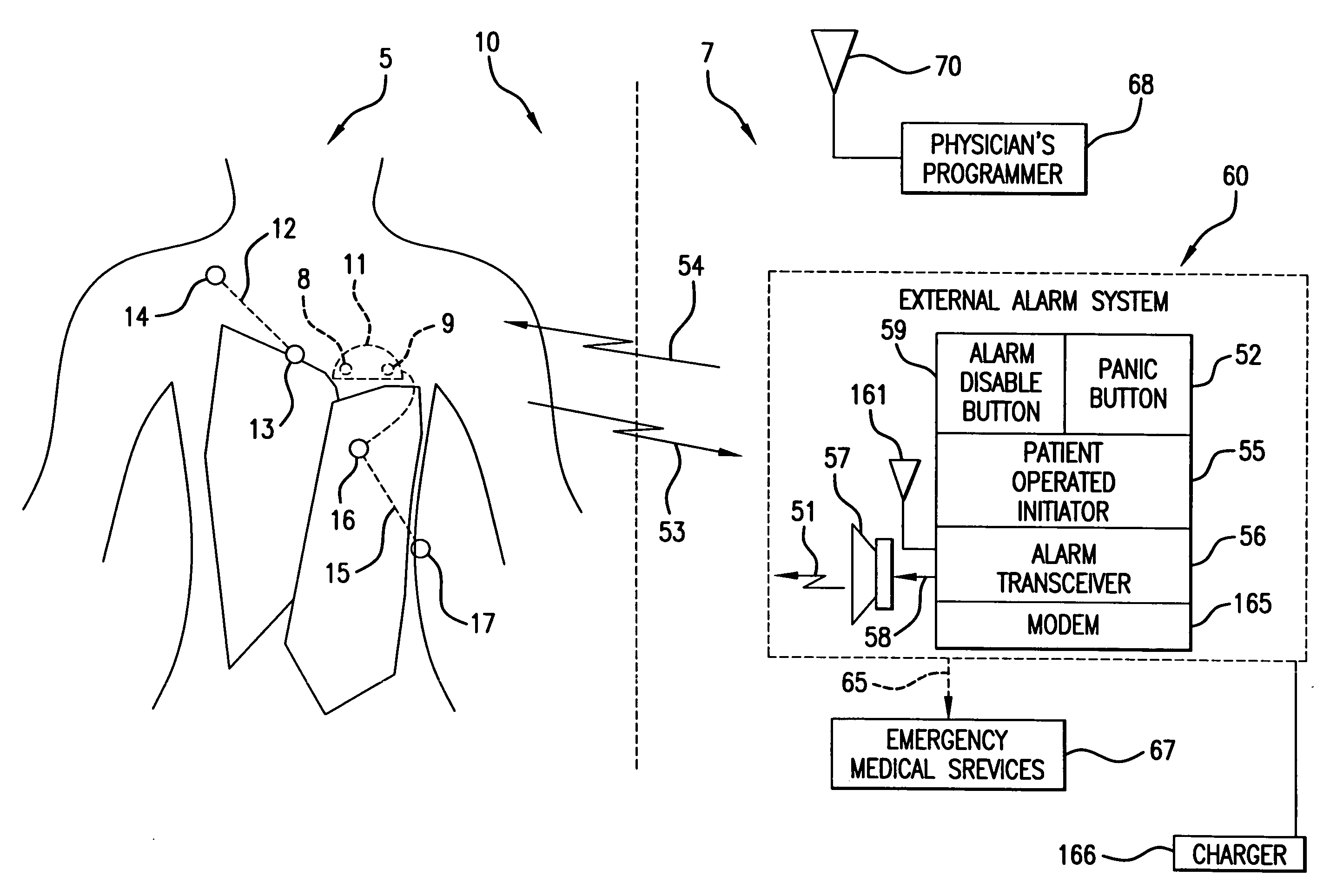 System and methods for analyzing QRS curvature to detect cardiac events