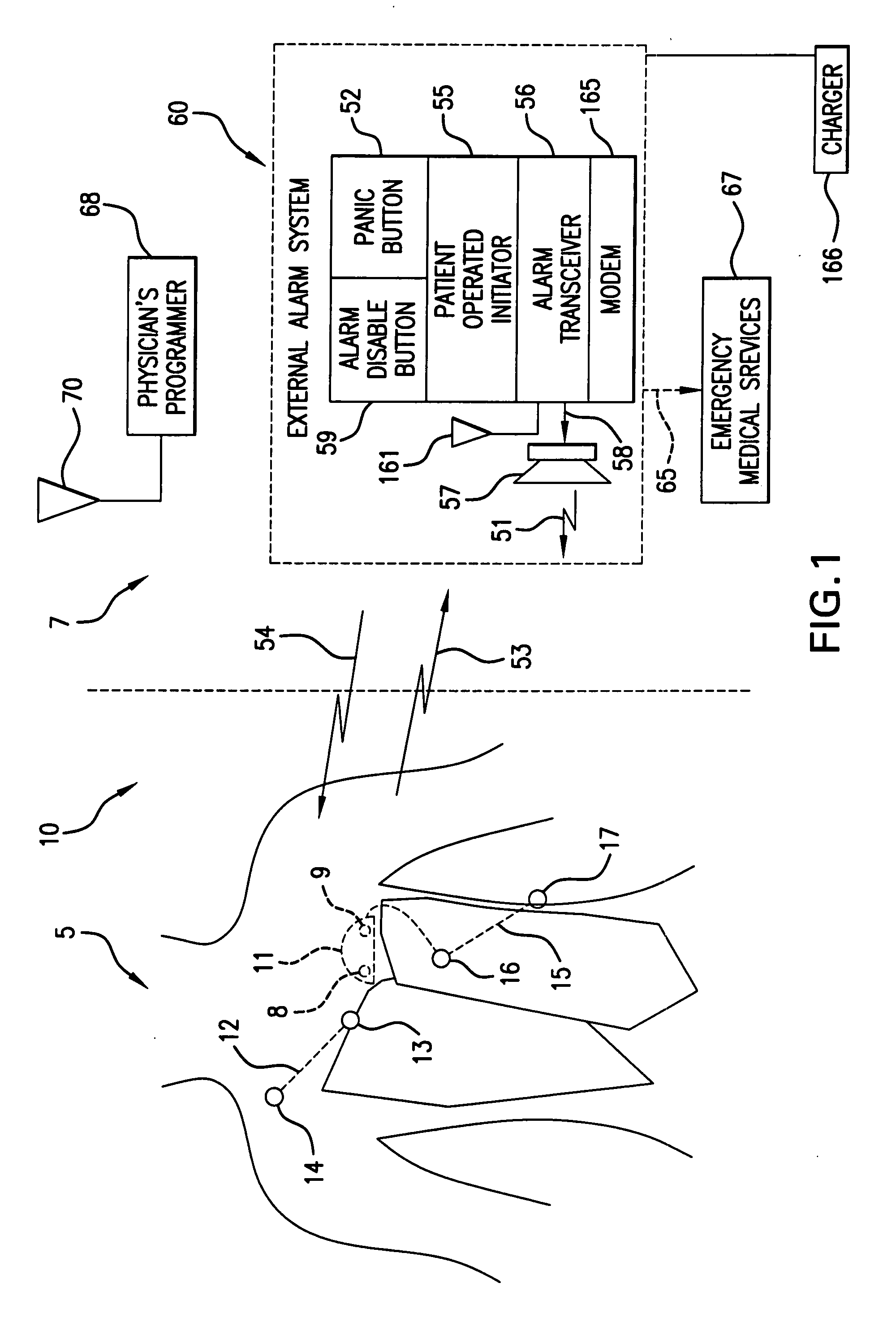 System and methods for analyzing QRS curvature to detect cardiac events