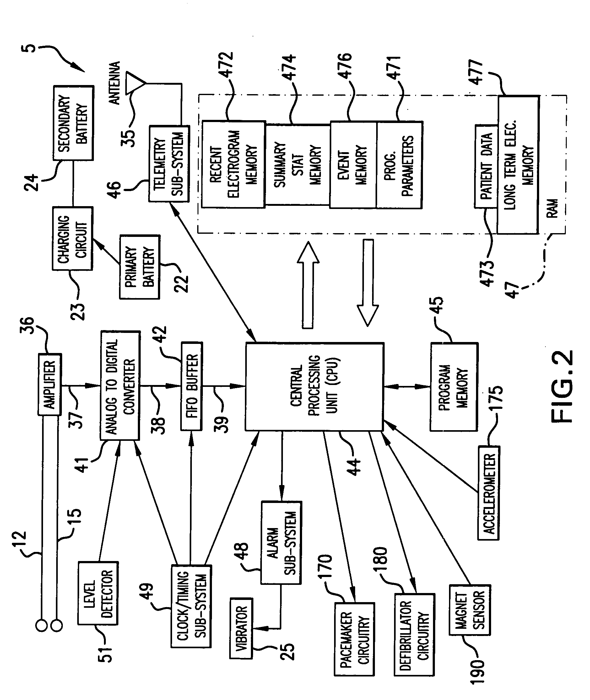 System and methods for analyzing QRS curvature to detect cardiac events