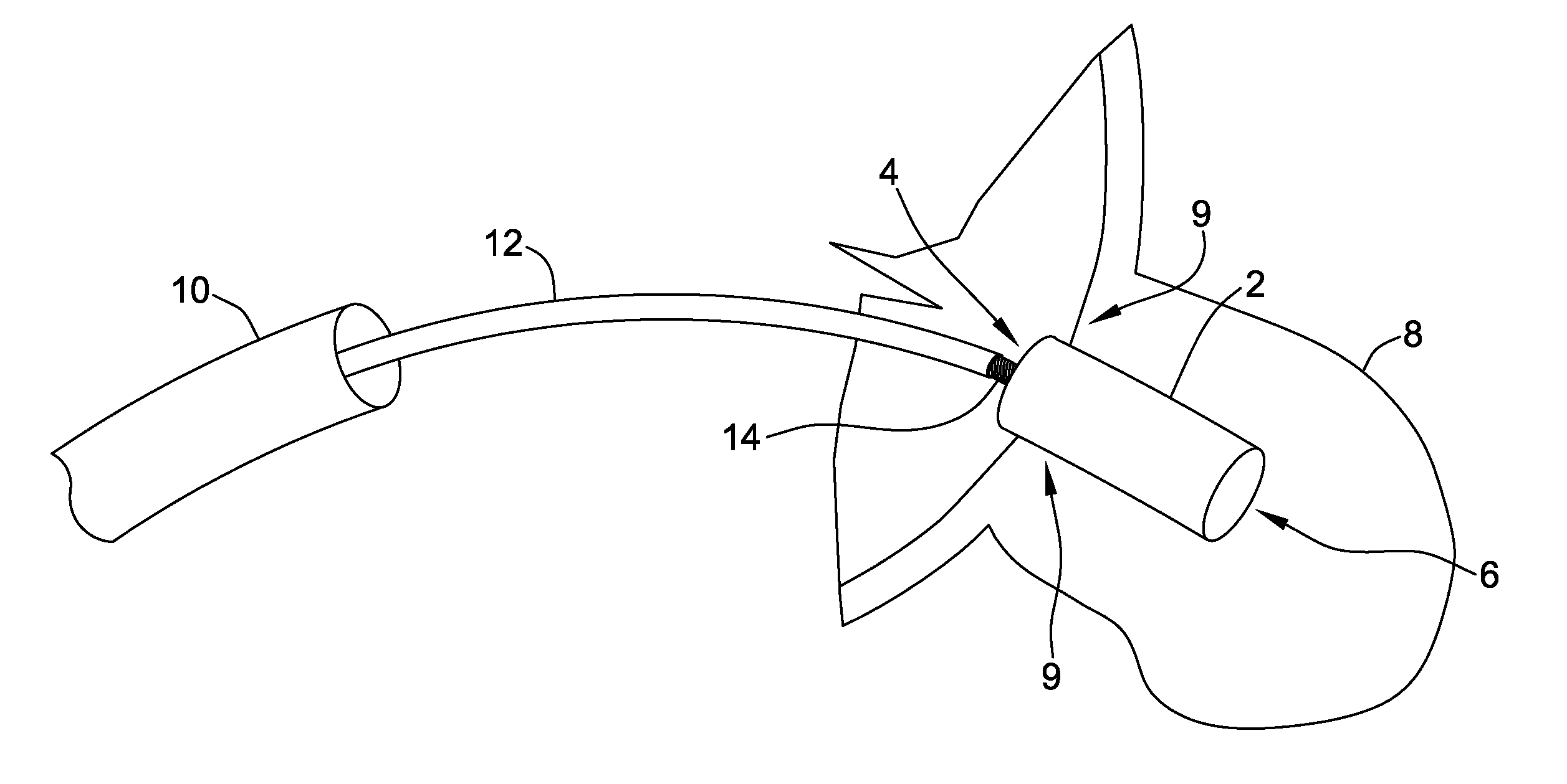 Occlusion devices and methods of making and using same