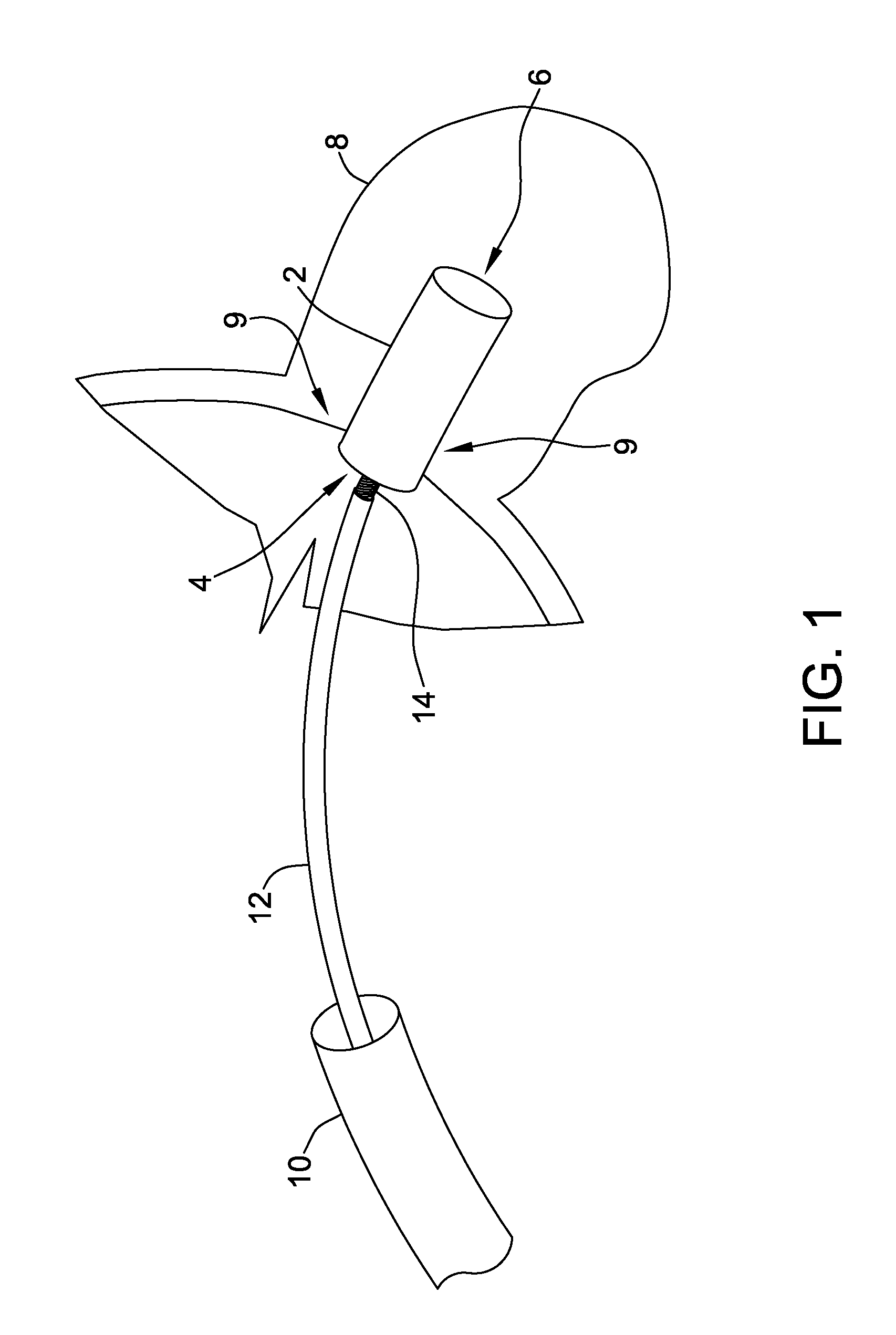 Occlusion devices and methods of making and using same