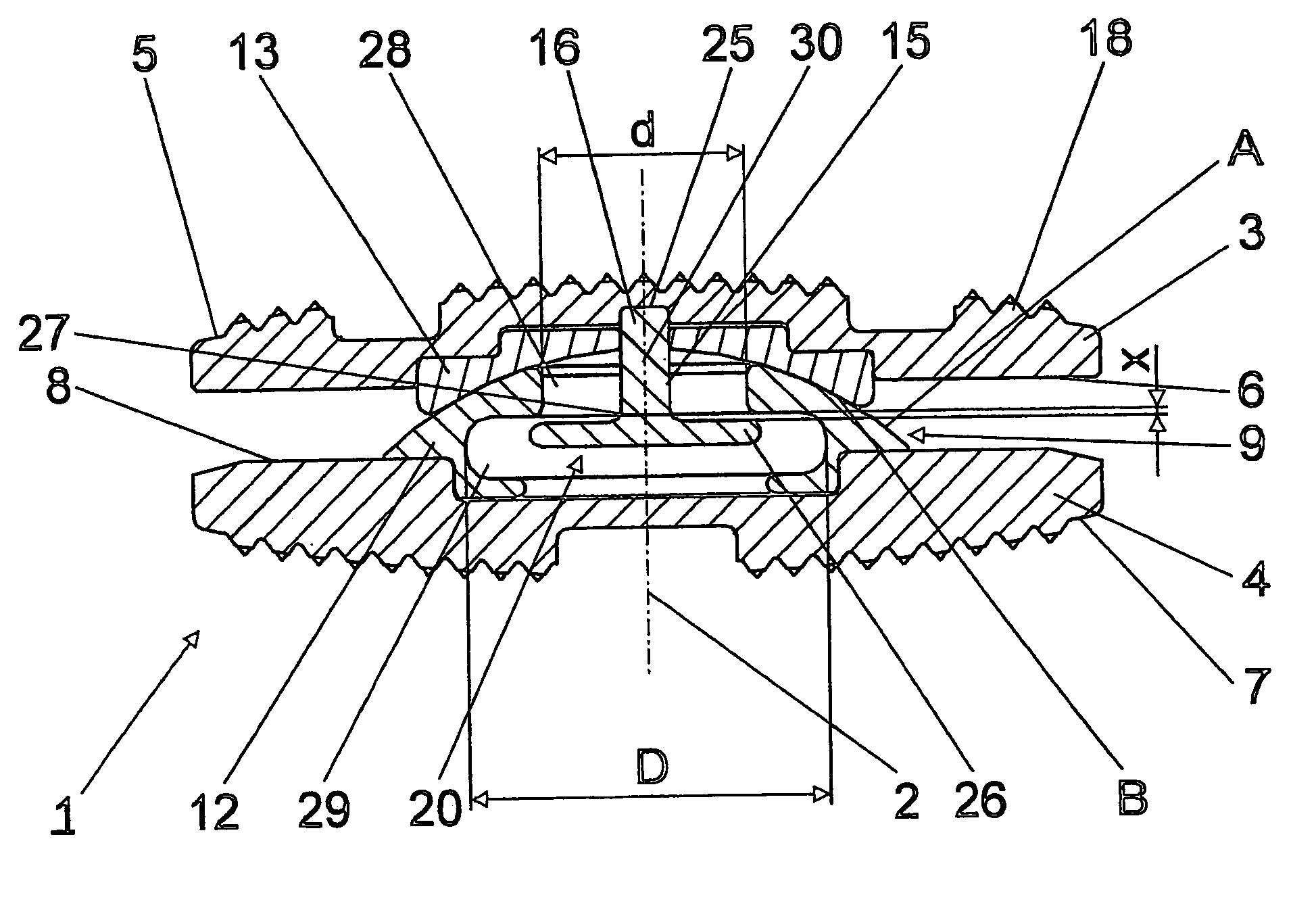 Intervertebral implant comprising dome-shaped joint surfaces
