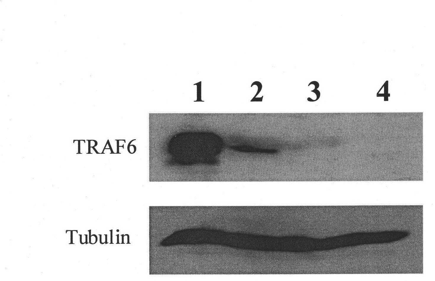 shRNA for inhibiting mouse TRAF6 gene expression and application thereof