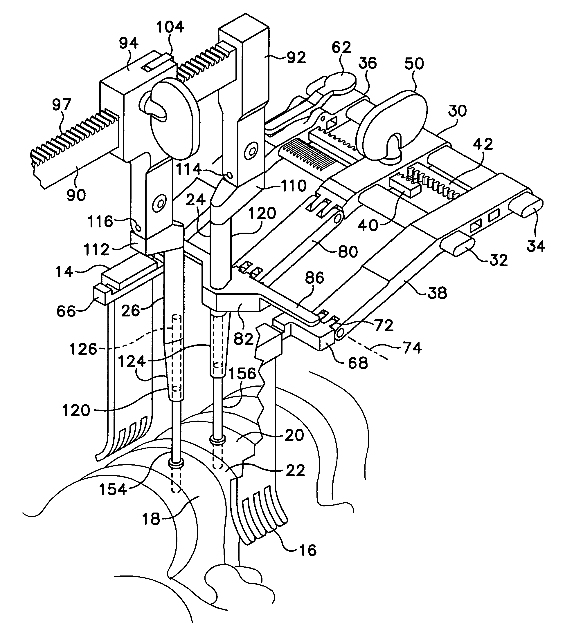 Retractor and distractor system for use in anterior cervical disc surgery