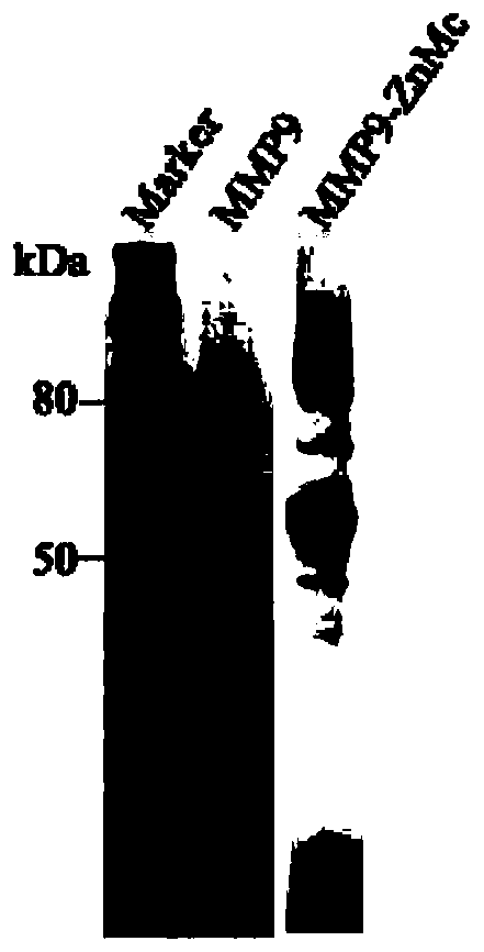 Single-domain antibody specifically for MMP9 protein ZnMc structural domain as well as product and application thereof