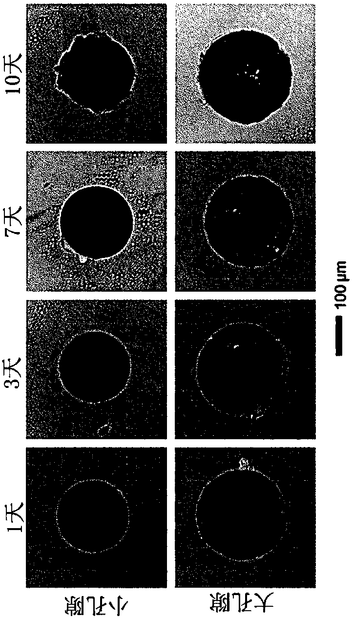 Injectable composition for skin tissue regeneration or skin tissue volume increase comprising hollow porous microspheres
