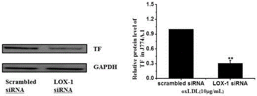 Recombinant protein function structure domain and use thereof in inhibition of macrophage tissue factor expression