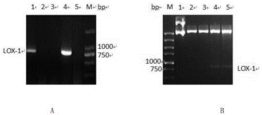 Recombinant protein function structure domain and use thereof in inhibition of macrophage tissue factor expression
