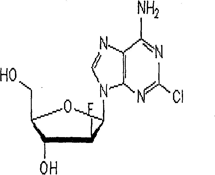 Freezing-dried clofarabine powder injection and its preparation method