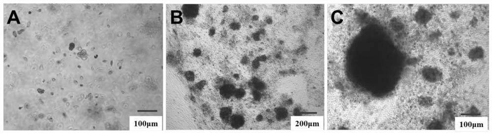 Mucous membrane melanoma 3D (three-dimensional) organ as well as culture method and application thereof