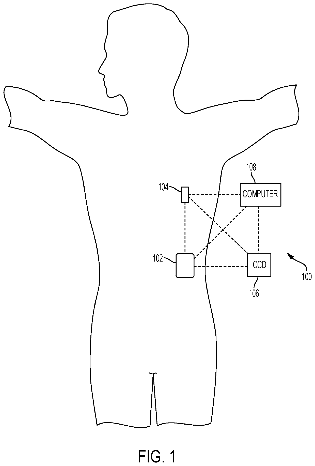 Fluid infusion system that automatically determines and delivers a correction bolus