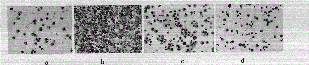 A composition for treating allergic asthma and its preparation method