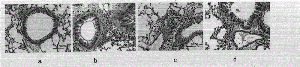 A composition for treating allergic asthma and its preparation method