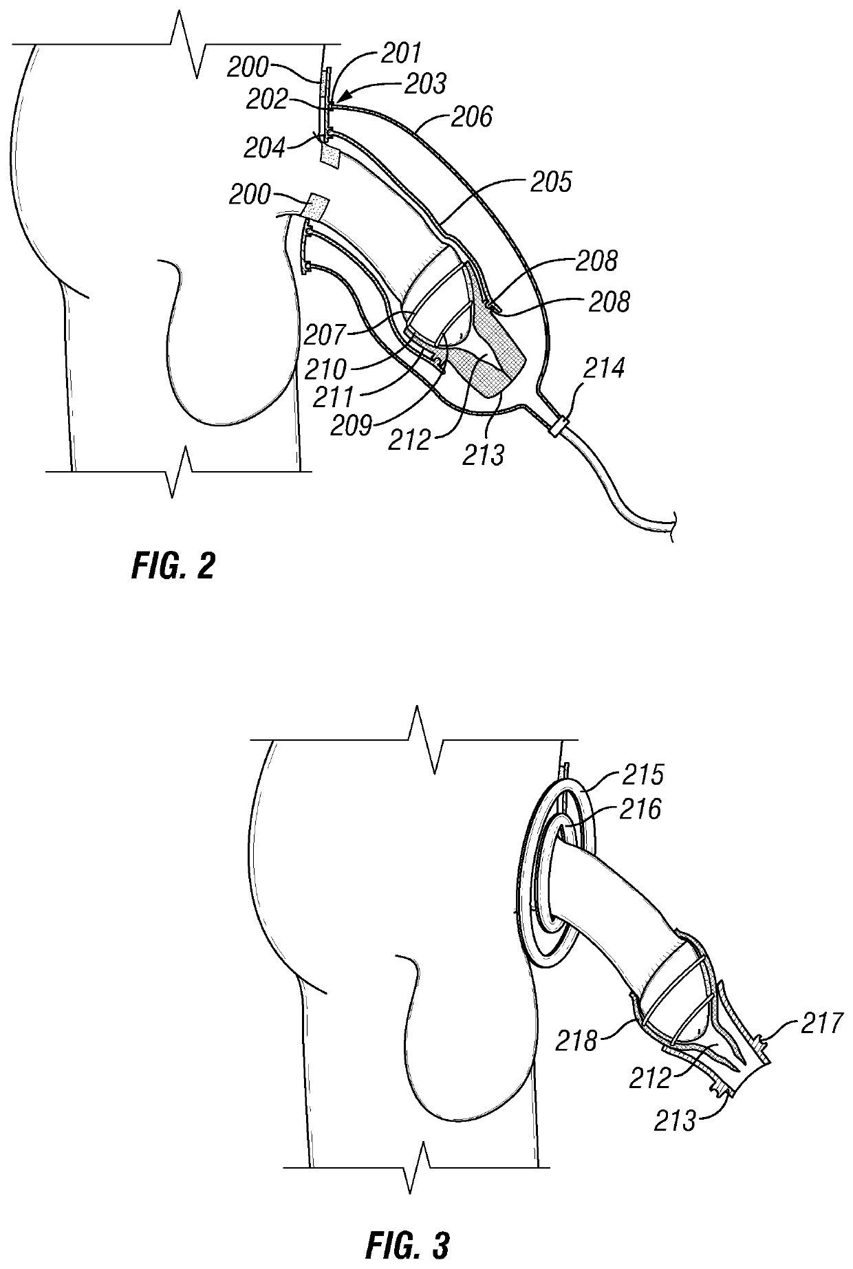 Urine collection apparatuses