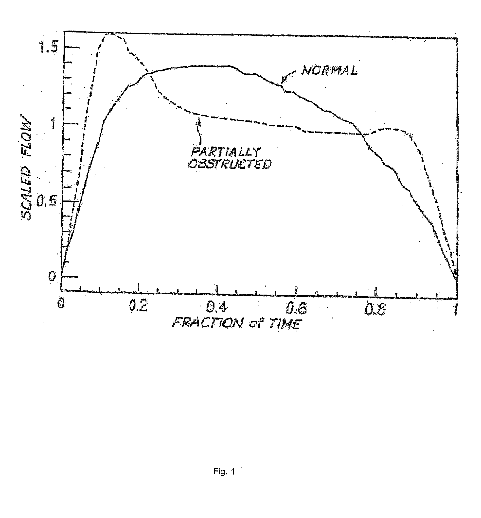 Method and Apparatus for Resolving Upper Airway Obstruction, Resistance or Instability