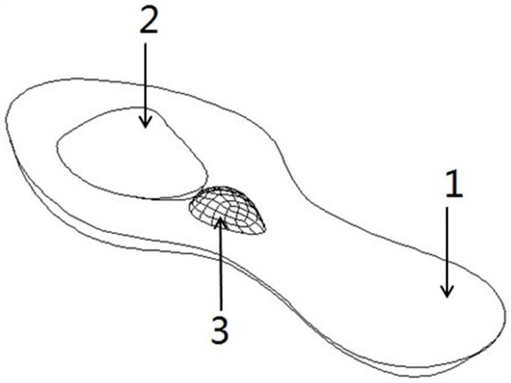 Medical image-based orthopedic insole manufacturing method