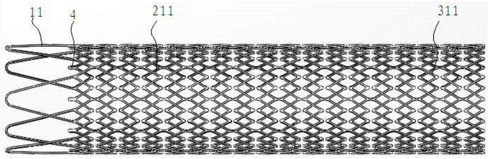 A kind of vascular stent, its preparation method and application