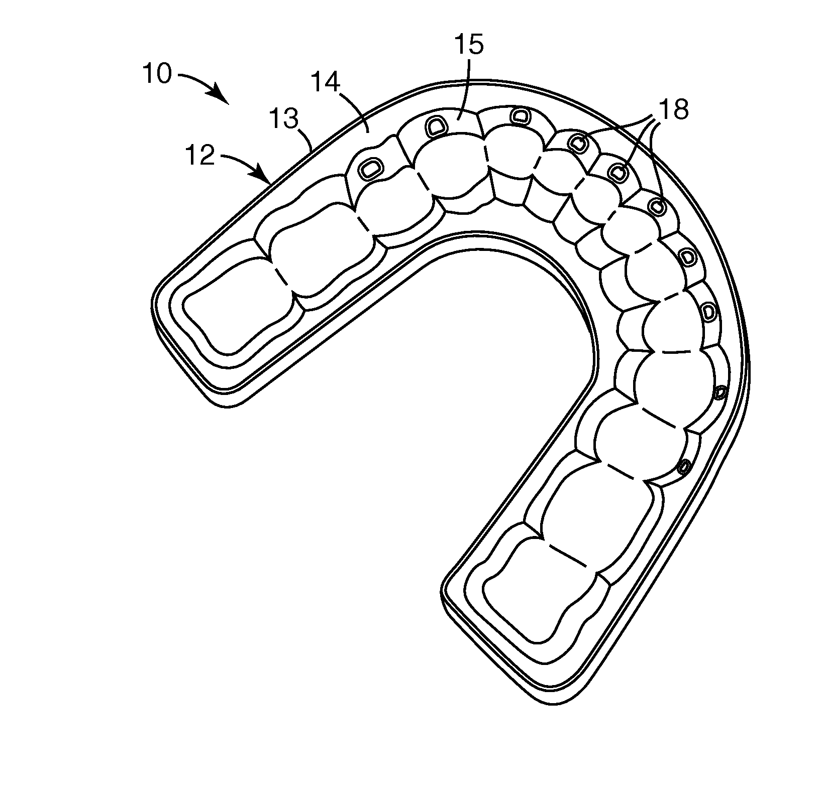 Methods and apparatus for bonding orthodontic appliances using photocurable adhesive material