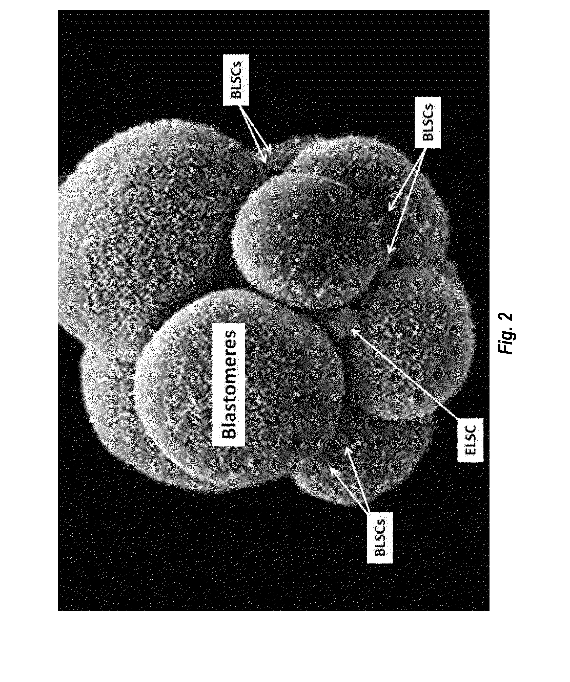 Identification, proliferation in situ, harvesting, separation, and transplantation of adult-derived regenerative pluripotent transitional blastomere-like stem cells and methods of treatment thereof